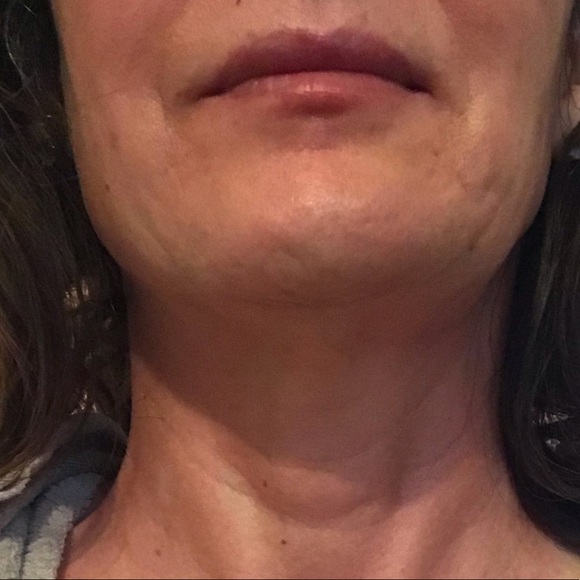 Venex® 1 Bee venom ointment w/honeybee venom
Natural Botox & great pain therapy - Picture 5 of 6